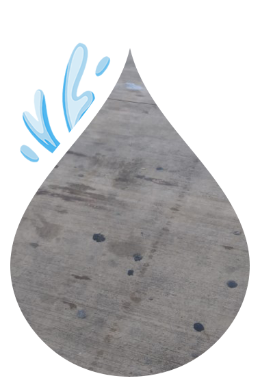 Gum Removal Dallas TX